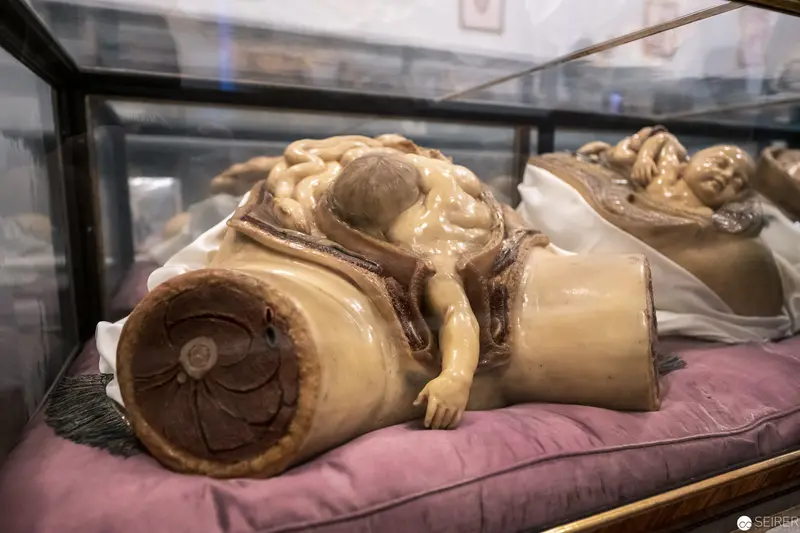 Anatomical Wax Model of Severed Body Part on Pink Cushion in Display Case