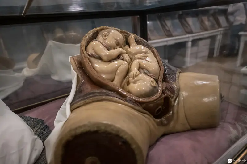 Anatomical Model of Fetal Development in Curled Prenatal Position