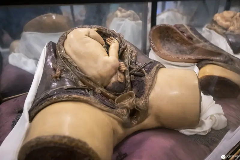 Anatomical Specimen of Fetal Development in Medical Museum Display