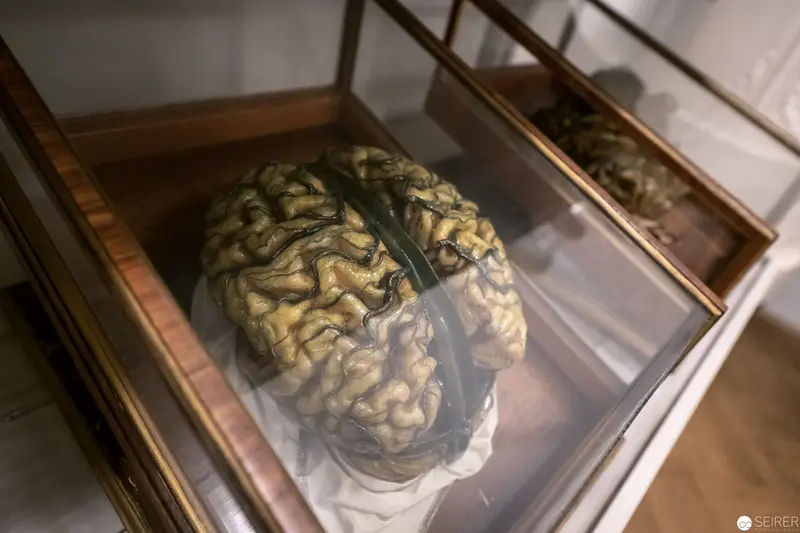 Preserved Human Brain in Glass Display Case: Scientific Specimen Archival
