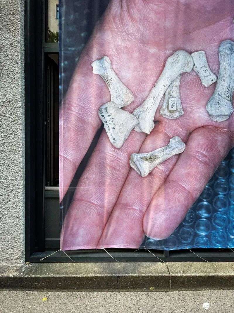 Fragmented Bone Fragments in Cupped Hand Against Window and Blue Surface