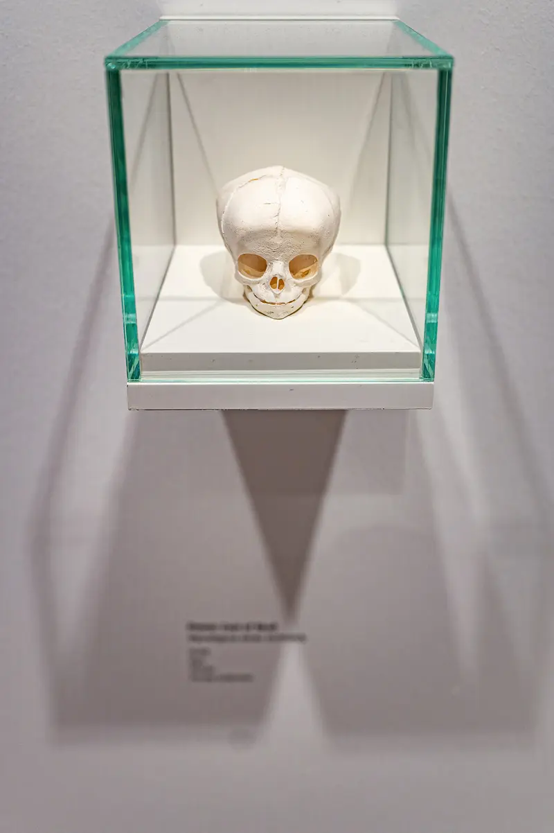 Anatomical Skull Specimen Displayed in Minimalist Glass Museum Case